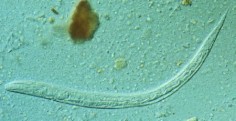 Larwa węgorka jelitowego© US Seal