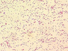 Brucella spp.© Larry Stauffer, Oregon State Public Health