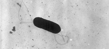 Listeria