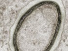 Abergel C & Claverie Jean-Michel IGS CNRS-AMU