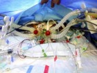 Inselspital