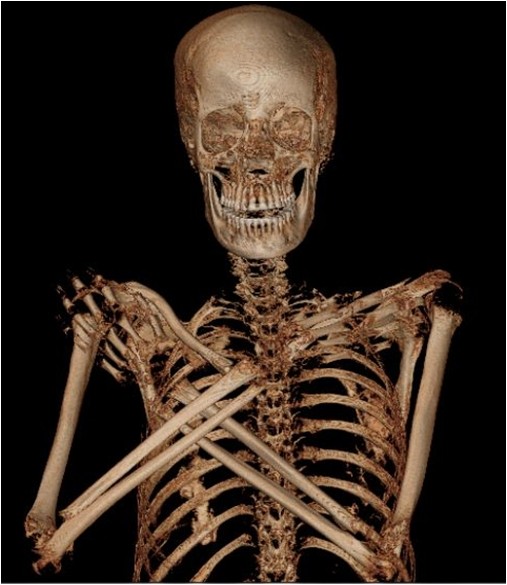 Warsaw Mummy Project