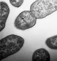 Stenotrophomonas maltophilia © University of Bristol, Matthew Avison