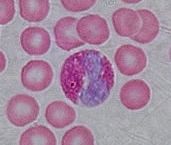 Eozynofil