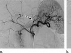 Radiological Society of North America