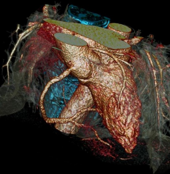 Siemens Healthcare