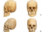Knipper et al.