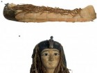 Saleem SN and Hawass Z (2021), Front. Med. 8:778498. doi: 10.3389/fmed.2021.778498