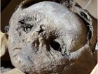 Andreas G. Nehrlich et al. „Adipositas and metabolic bone disorder in a 16th century Upper Austrian infant crypt mummy”, Front. Med., 26 October 2022