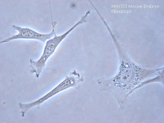 Mysie fibroblasty
