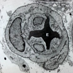 Perycyt