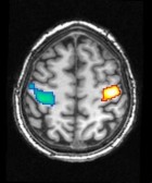 MPI of Psychiatry