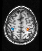 MPI of Psychiatry